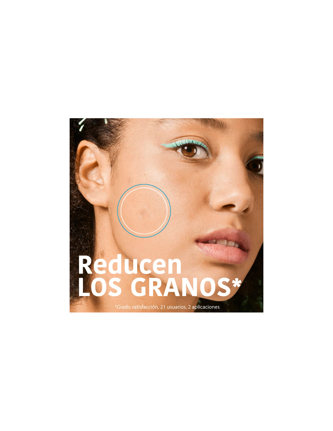 IROHA PARCHES SOS GRANOS CON ÁCIDO SALICÍLICO...