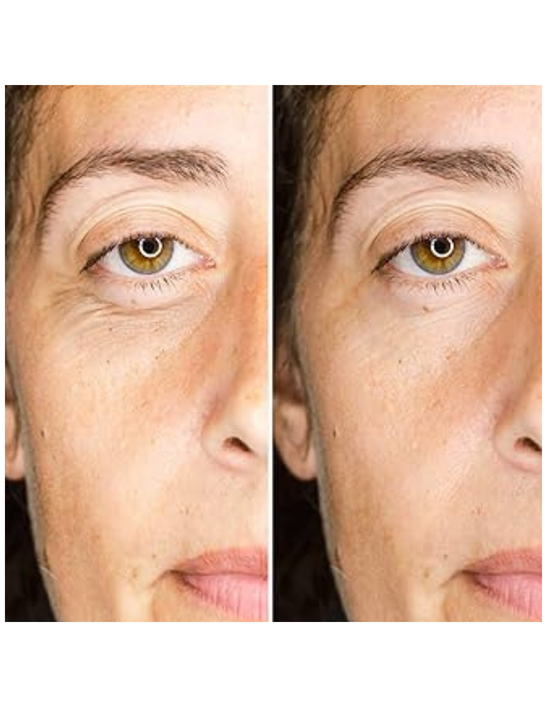 CAMALEON MAGIC SERUM CORRECTOR BOLSAS Y OJERAS...