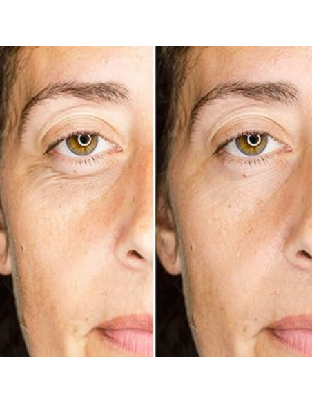 CAMALEON MAGIC SERUM CORRECTOR BOLSAS Y OJERAS EFECTO FLASH - 1 unidad (para 8 veces)