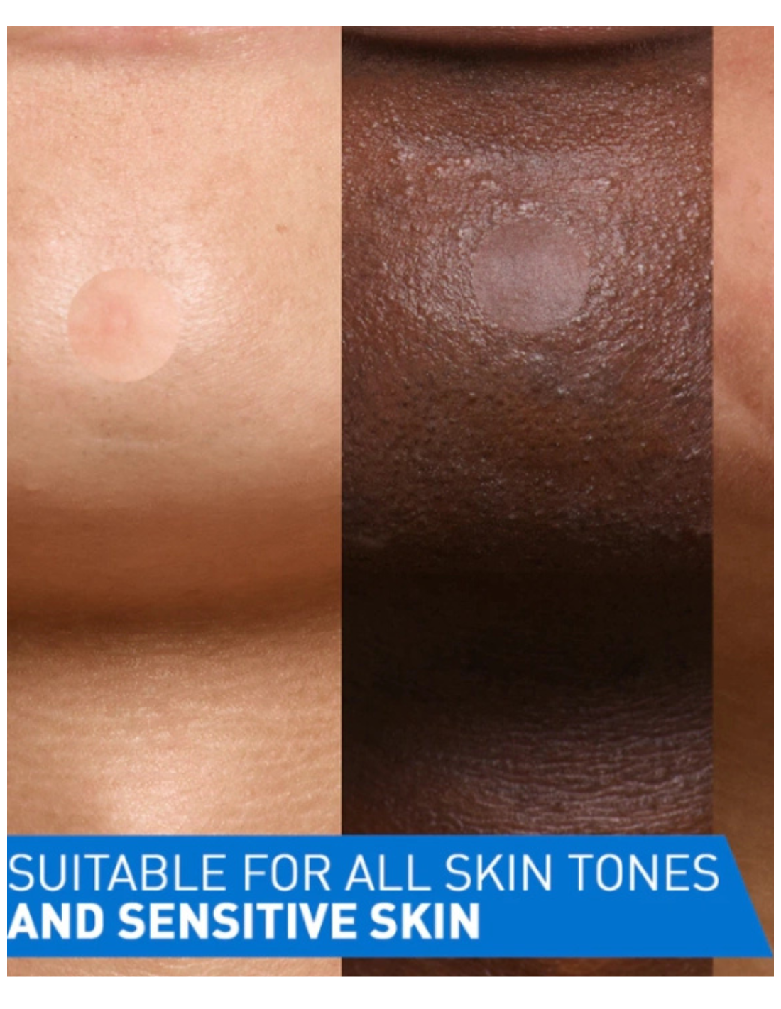 CERAVE PARCHES CONTROL IMPERFECCIONES 22 UNIDADES