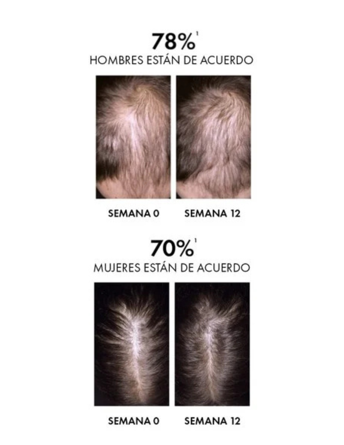 VICHY DERCOS SERUM CAPILAR REGENERADOR AMINEXIL...