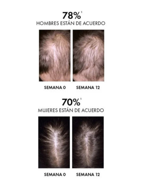 VICHY DERCOS SERUM CAPILAR REGENERADOR AMINEXIL CLINICAL R.E.G.E.N BOOSTER 90mL