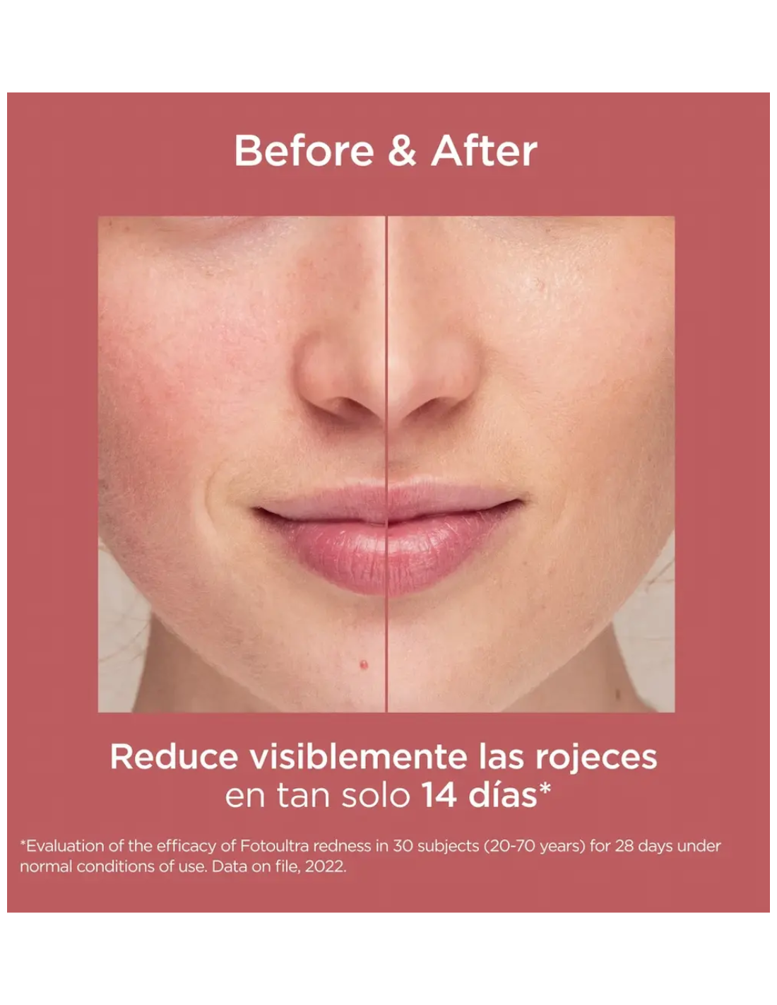 ISDIN FOTOULTRA REDNESS 50 ml