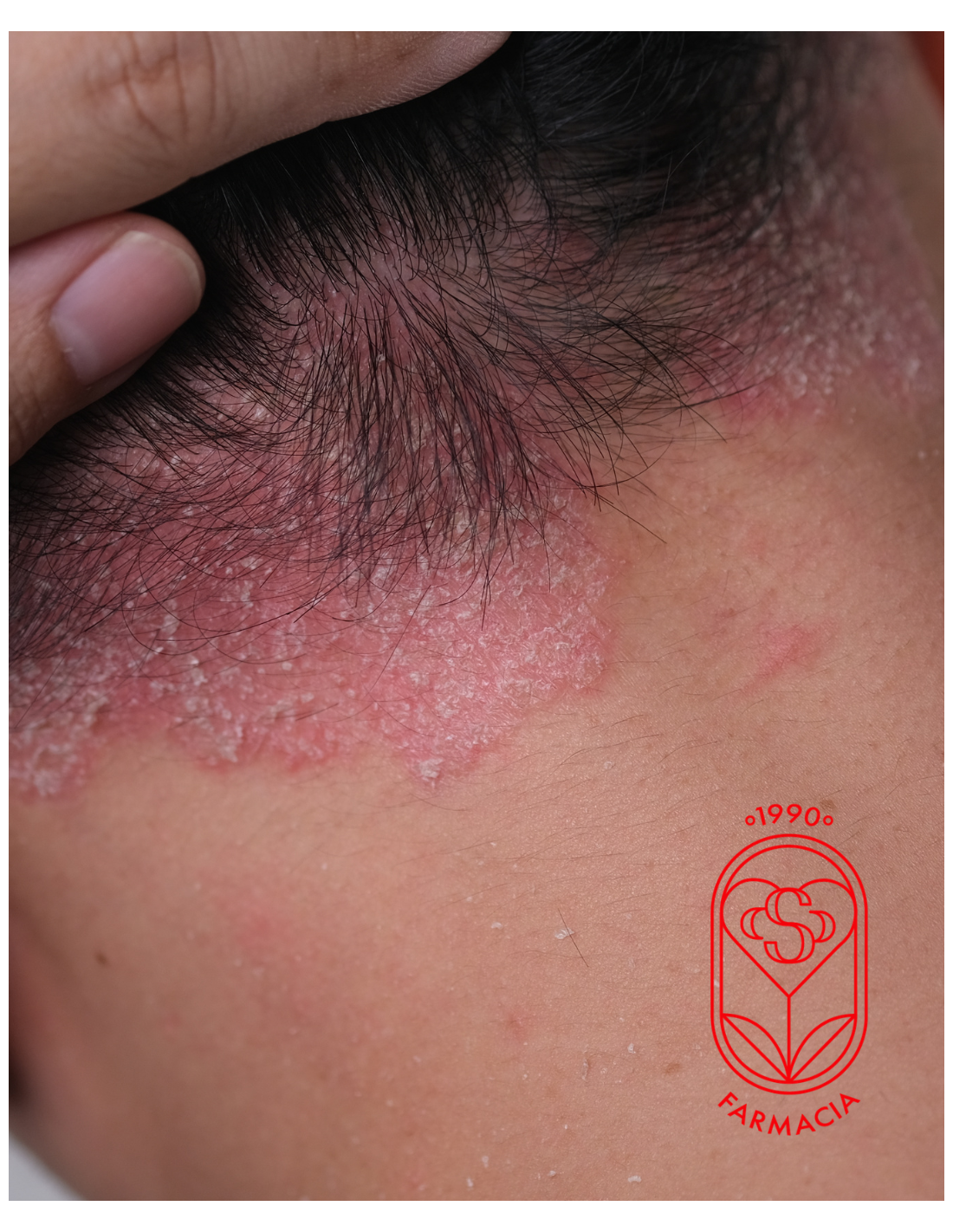 THE LAB JABÓN OZONIZADO DERMOHIGIENE 100 gramos