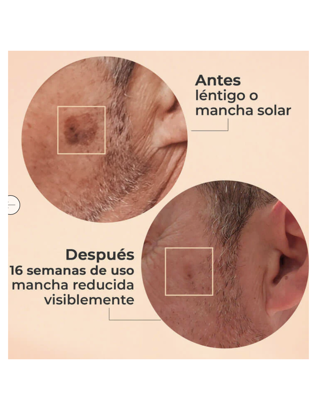 SEGLE SÉRUM GLICOLMIX 30ml 2