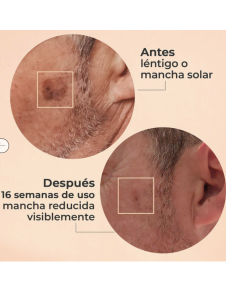 SEGLE SÉRUM GLICOLMIX 30ml