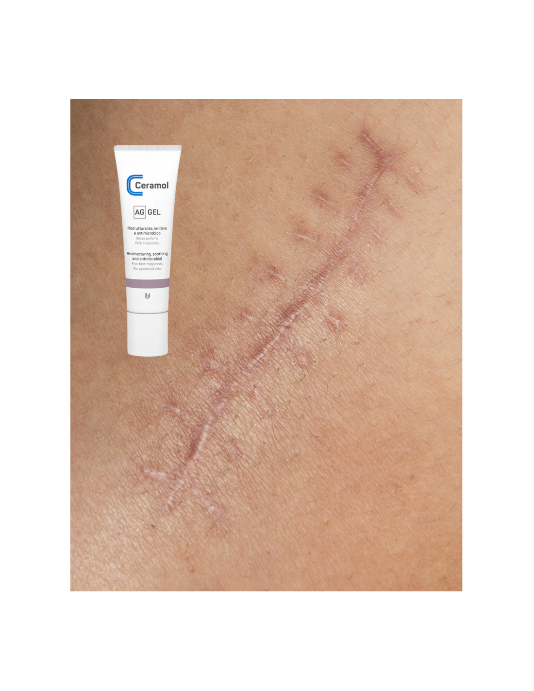 CERAMOL AG GEL 30ml