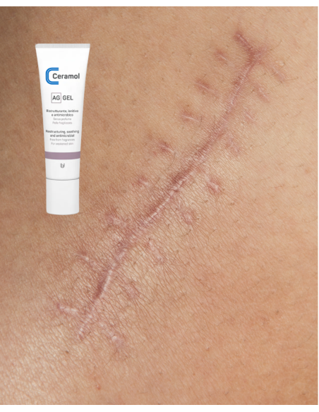 CERAMOL AG GEL 30ml