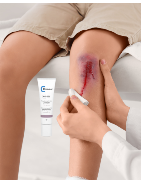 CERAMOL AG GEL 30ml
