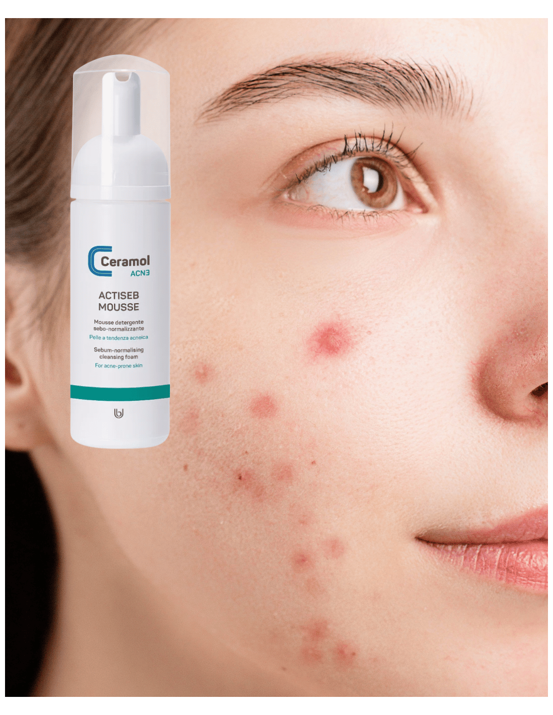 CERAMOL ACTISEB MOUSSE 150ml