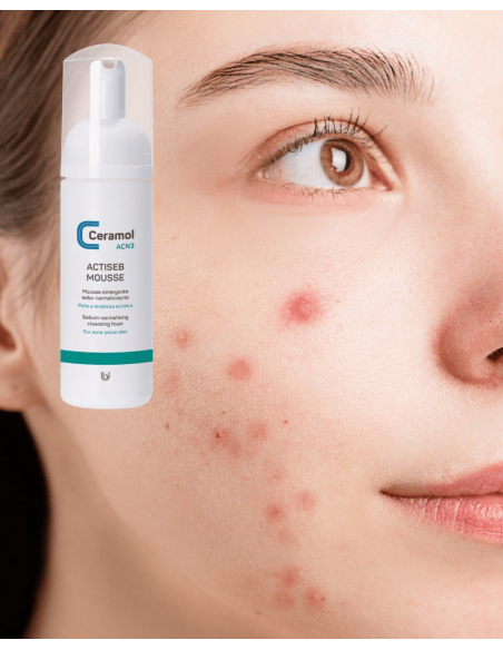 CERAMOL ACTISEB MOUSSE 150ml