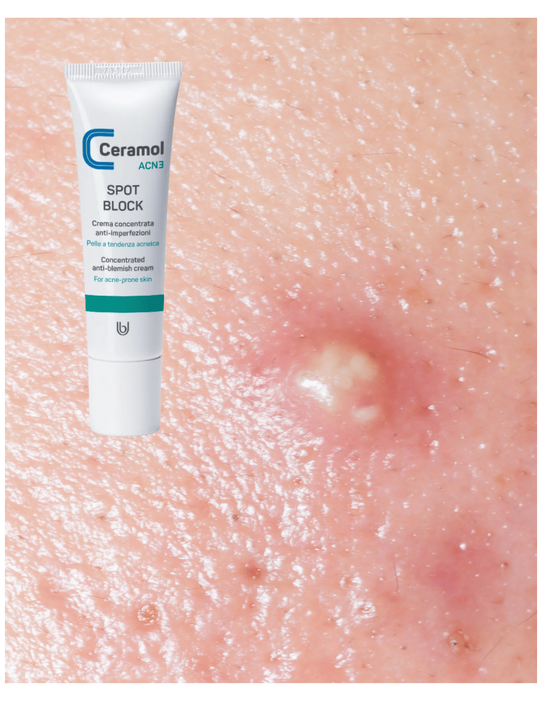 CERAMOL SPOT BLOCK 20ml