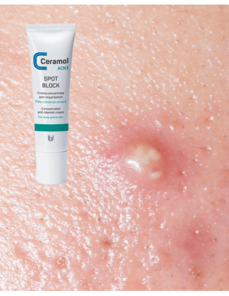 CERAMOL SPOT BLOCK 20ml