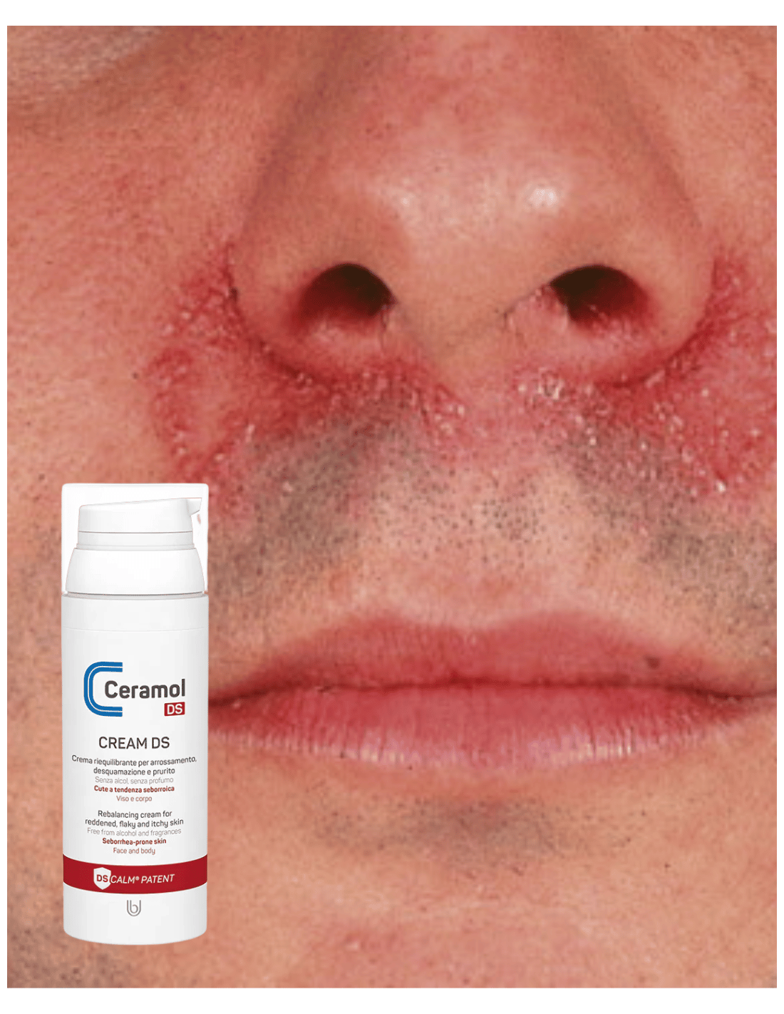 CERAMOL CREAM DS CREMA DERMATITIS SEBORREICA 50ml