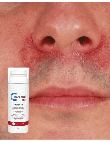 CERAMOL CREAM DS CREMA DERMATITIS SEBORREICA 50ml