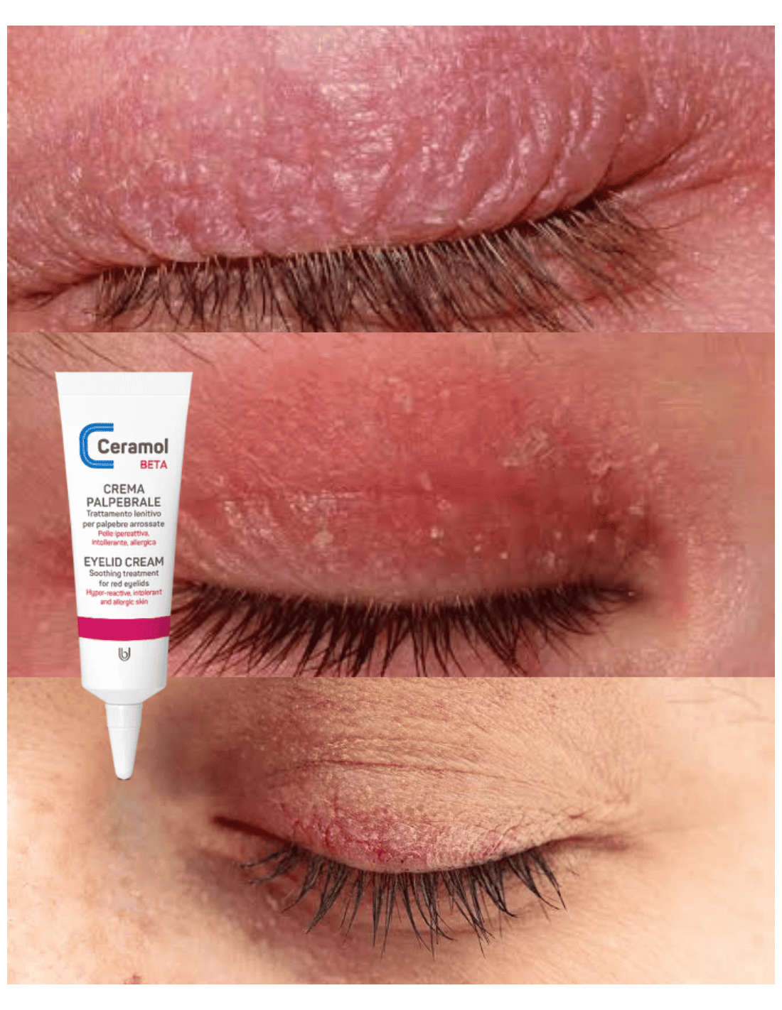 CERAMOL BETA CREMA DE PÁRPADOS 10ml