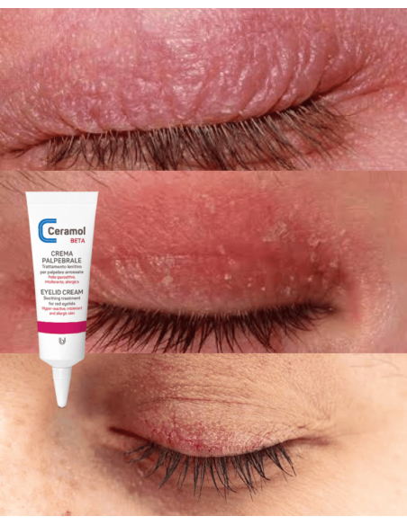 CERAMOL BETA CREMA DE PÁRPADOS 10ml