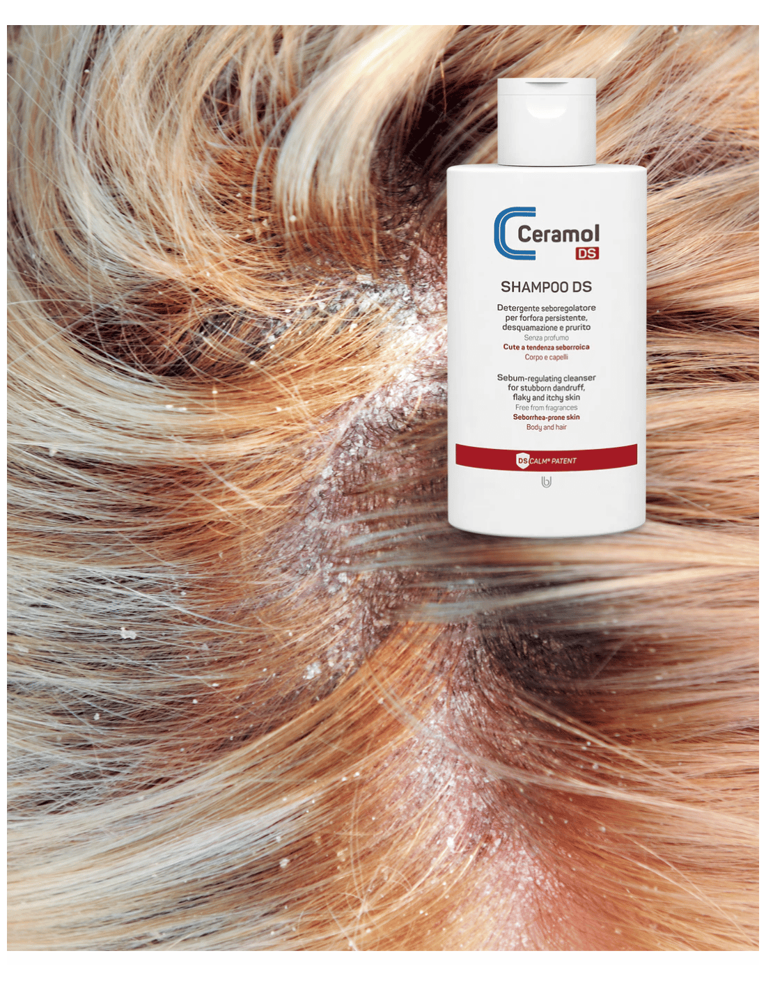 CERAMOL CHAMPÚ SHAMPOO DS 200ml