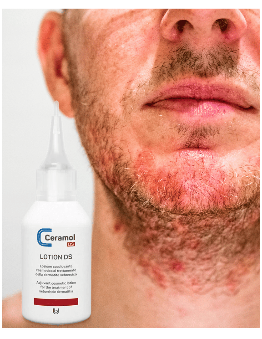 CERAMOL LOCIÓN LOTION DS 50ml