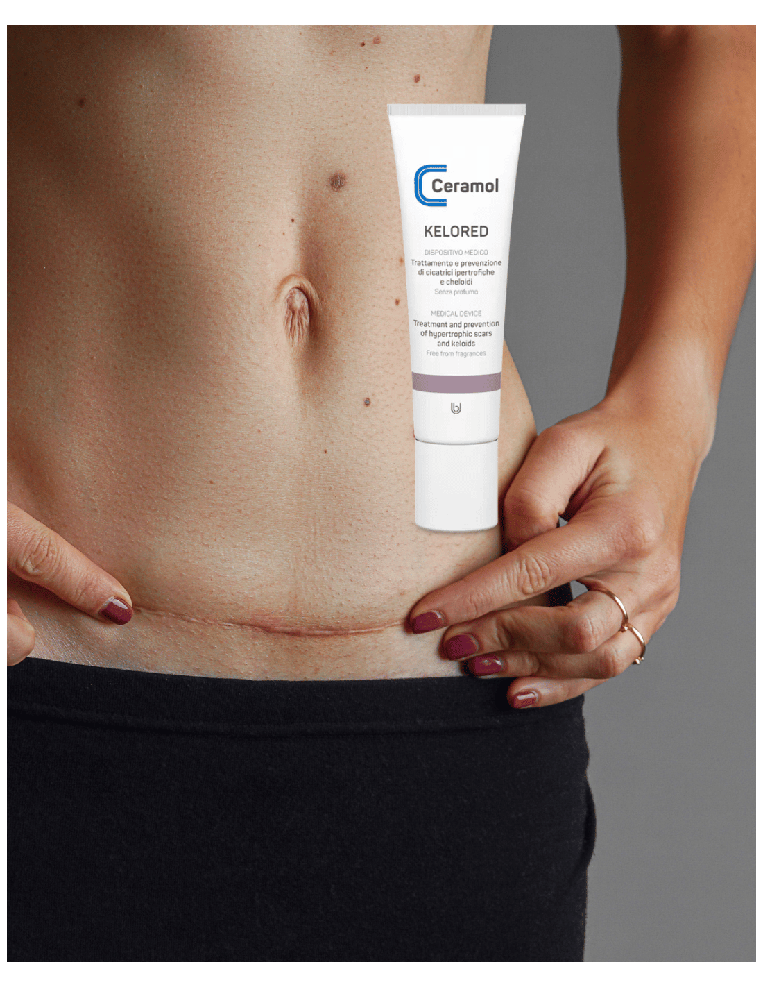 CERAMOL KELORED 30ml (cicatrices hipertróficas...