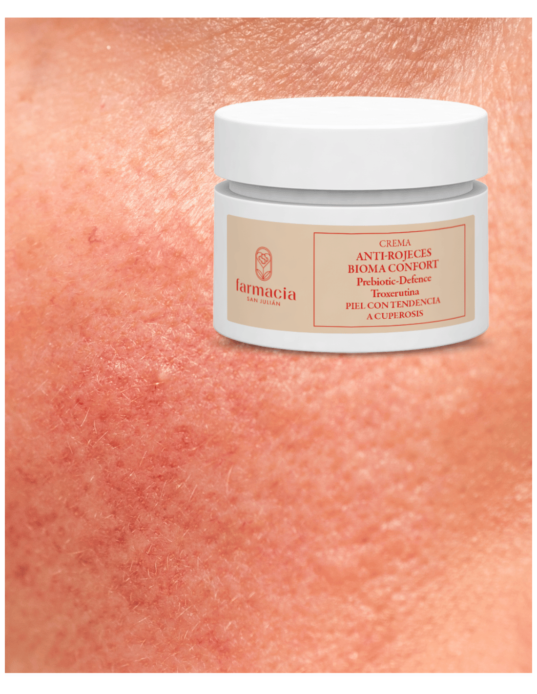 FSJ CREMA ANTI-ROJECES BIOMA CONFORT 50ml 2