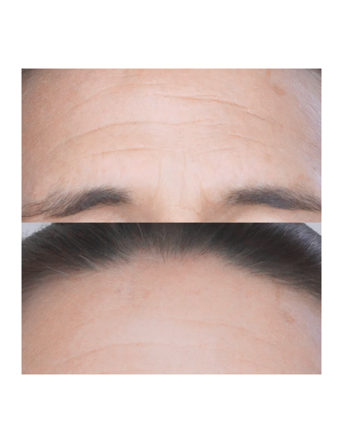 PATYKA COMBLEUR RIDES INSTANTANE AGE SPECIFIC INTENSIF -... 2