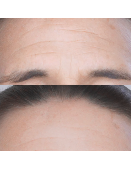 PATYKA COMBLEUR RIDES INSTANTANE AGE SPECIFIC INTENSIF - 15 ml